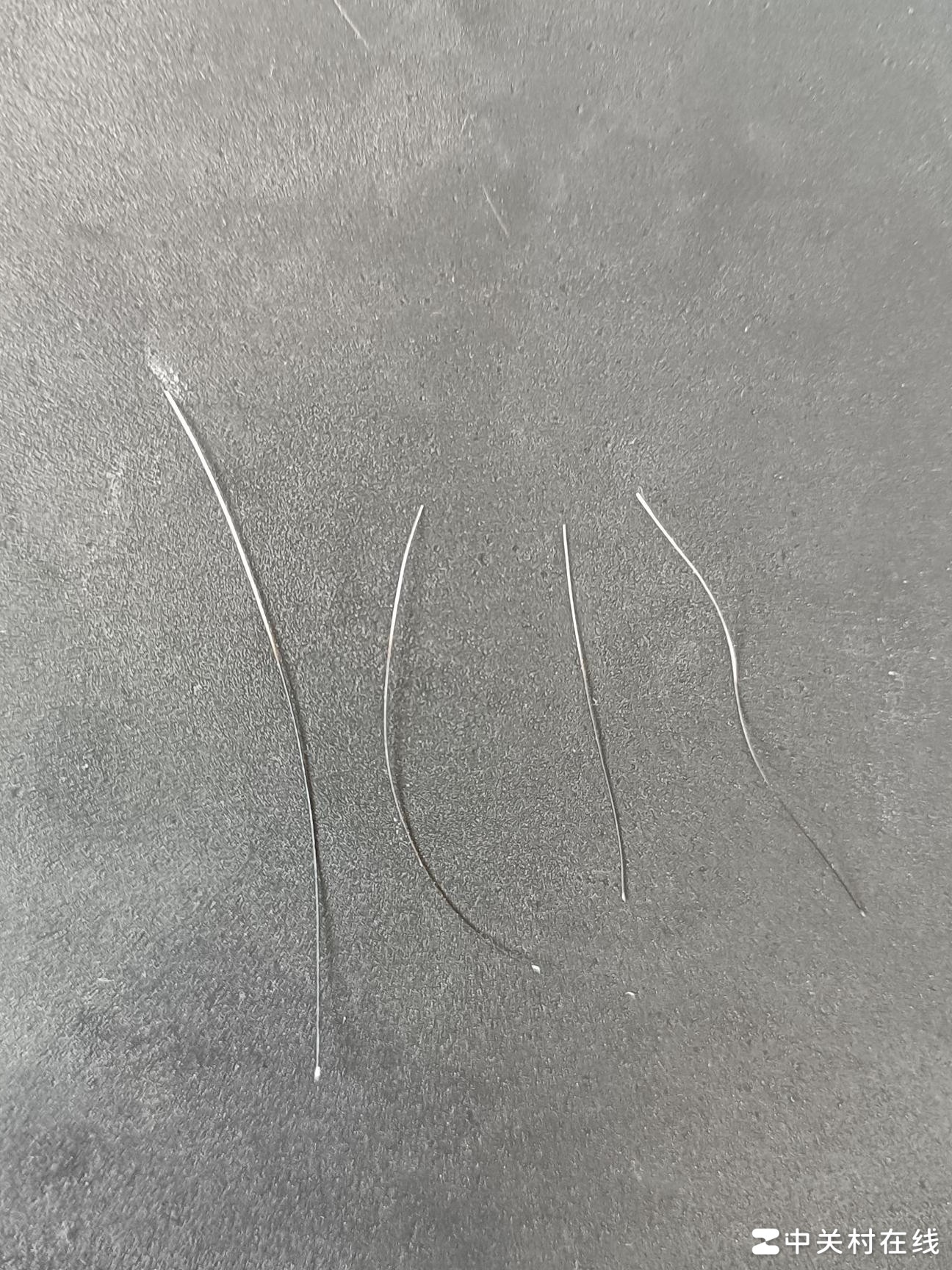 白发转黑，是恢复迹象吗？