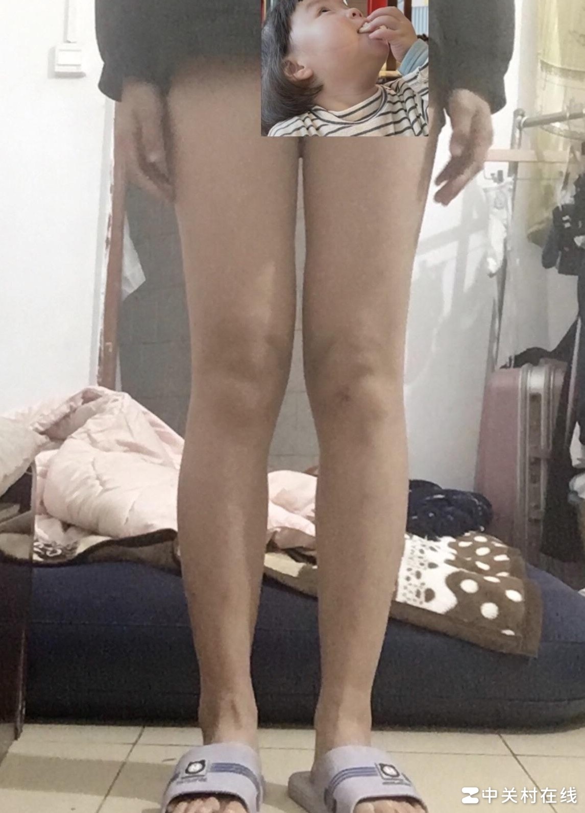 大腿48小腿34算粗吗