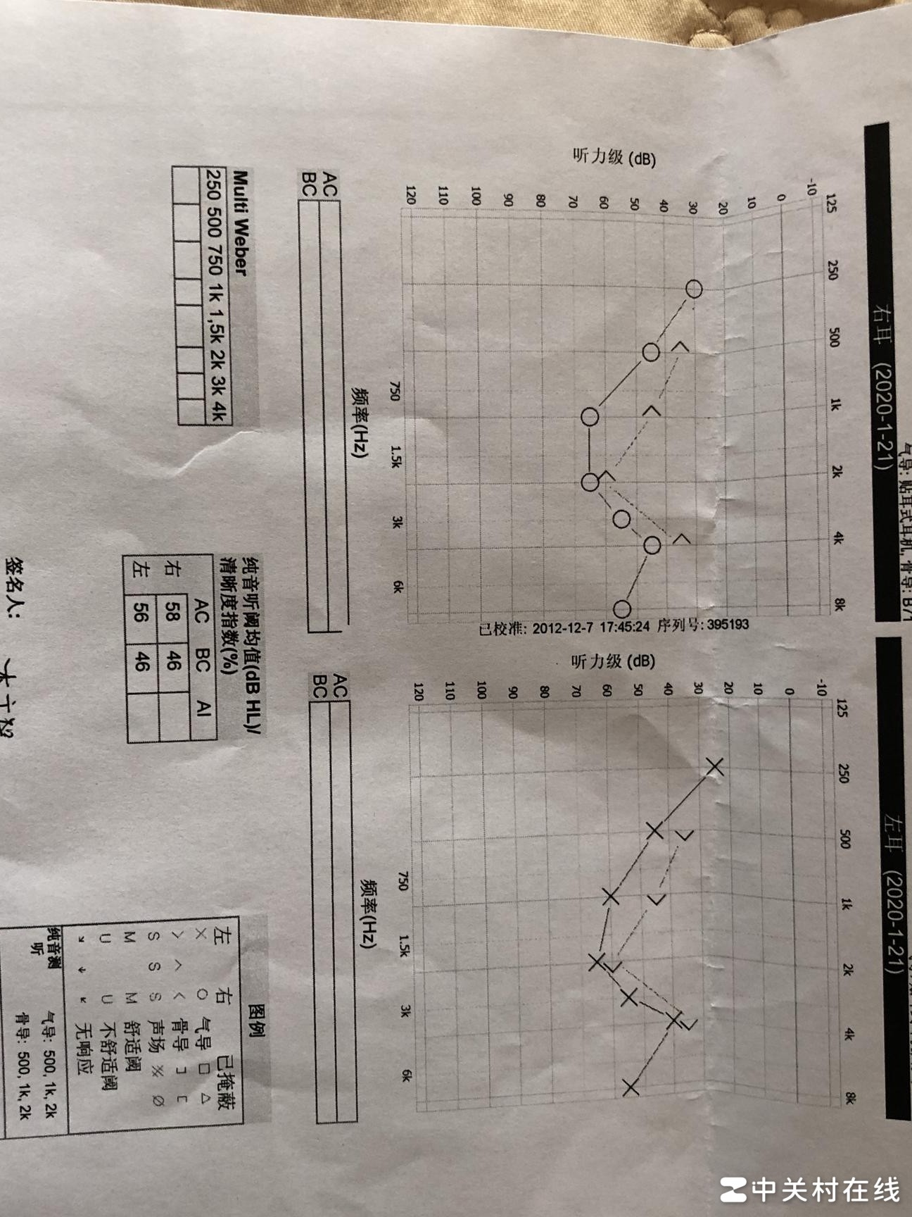 听力测试匹配助听器