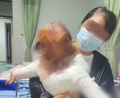 养生壶爆炸致烫伤，责任如何划分