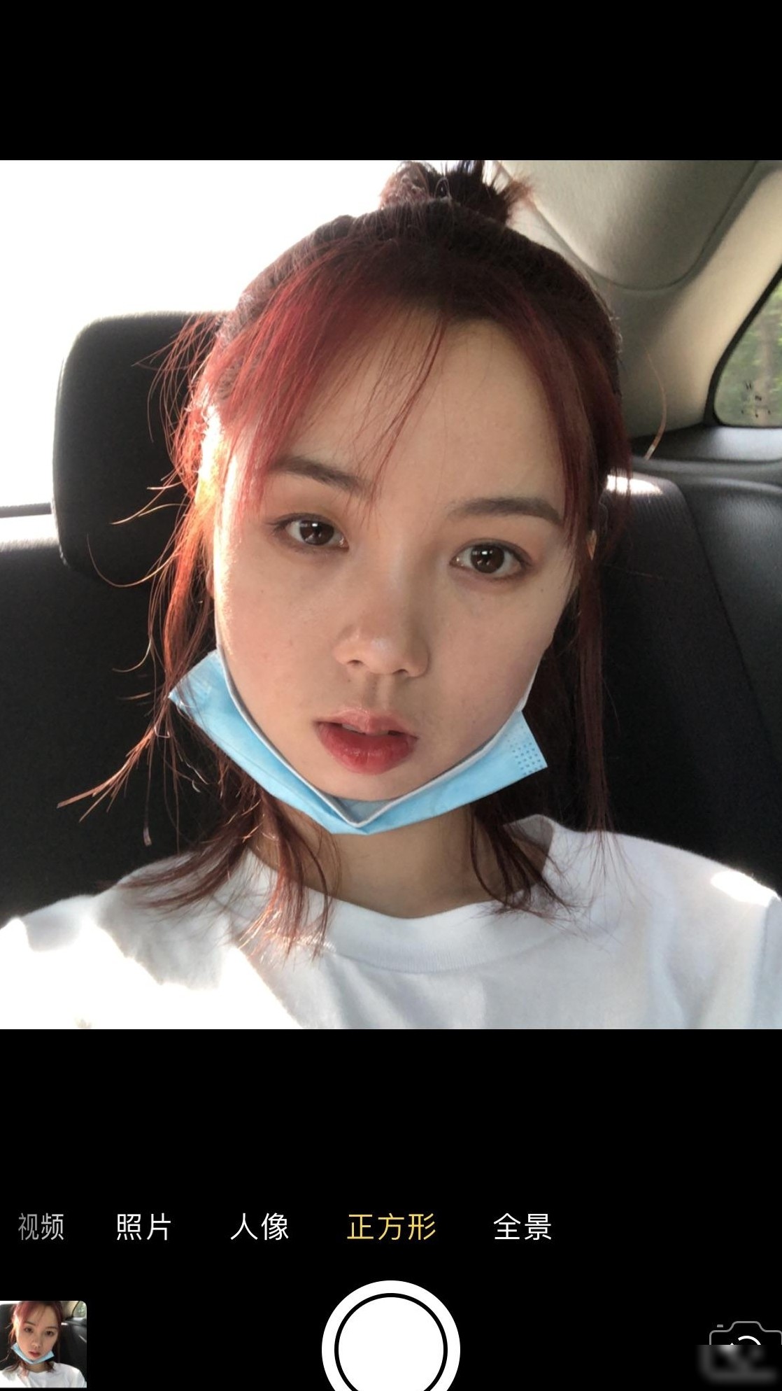大小眼矫正方法