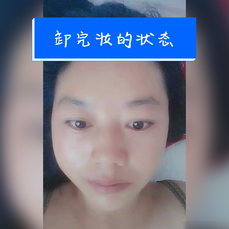 脸上有斑？科学祛斑方法