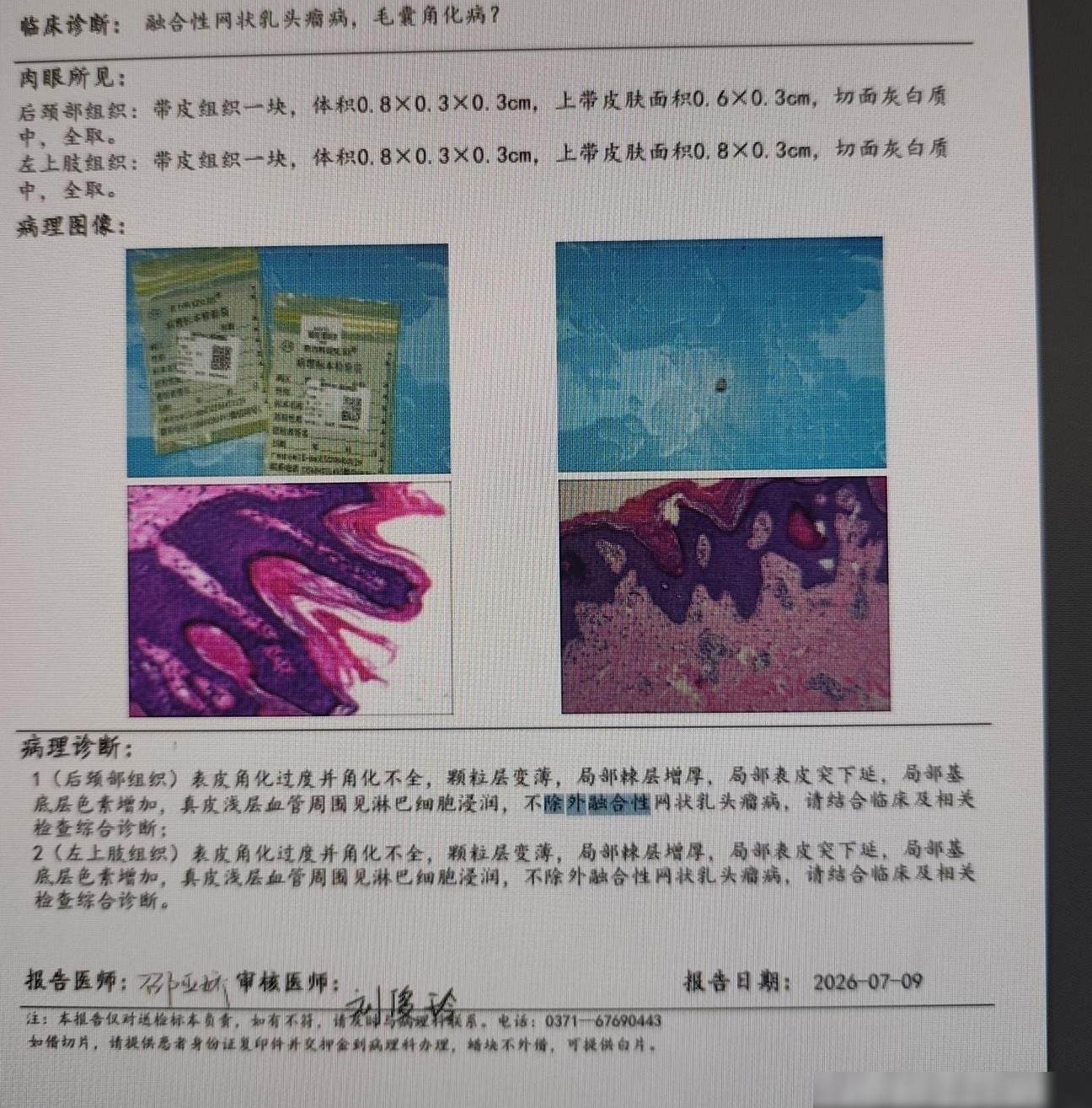 孩子皮肤久治不愈，求医求助
