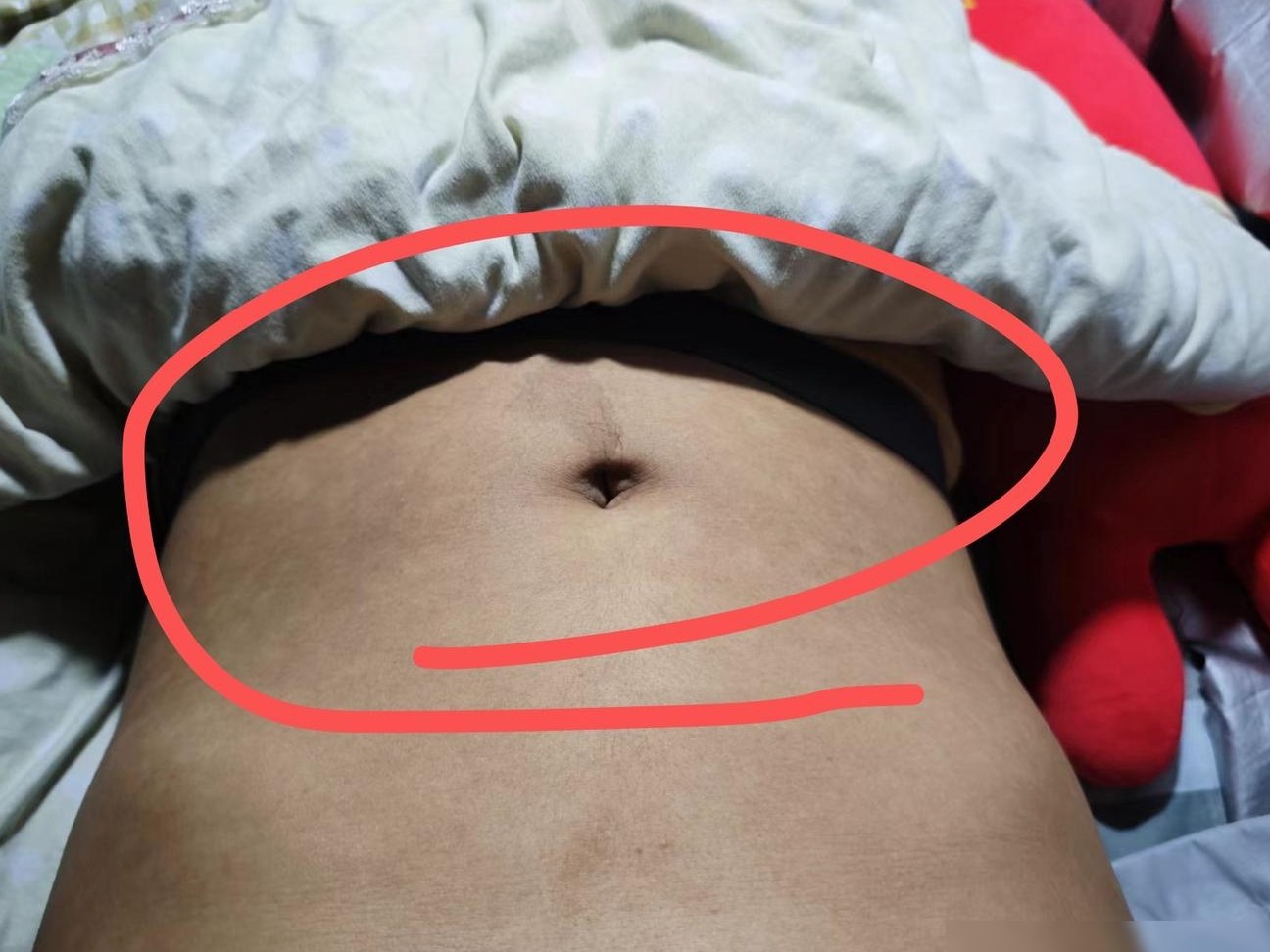 这是什么皮肤病？