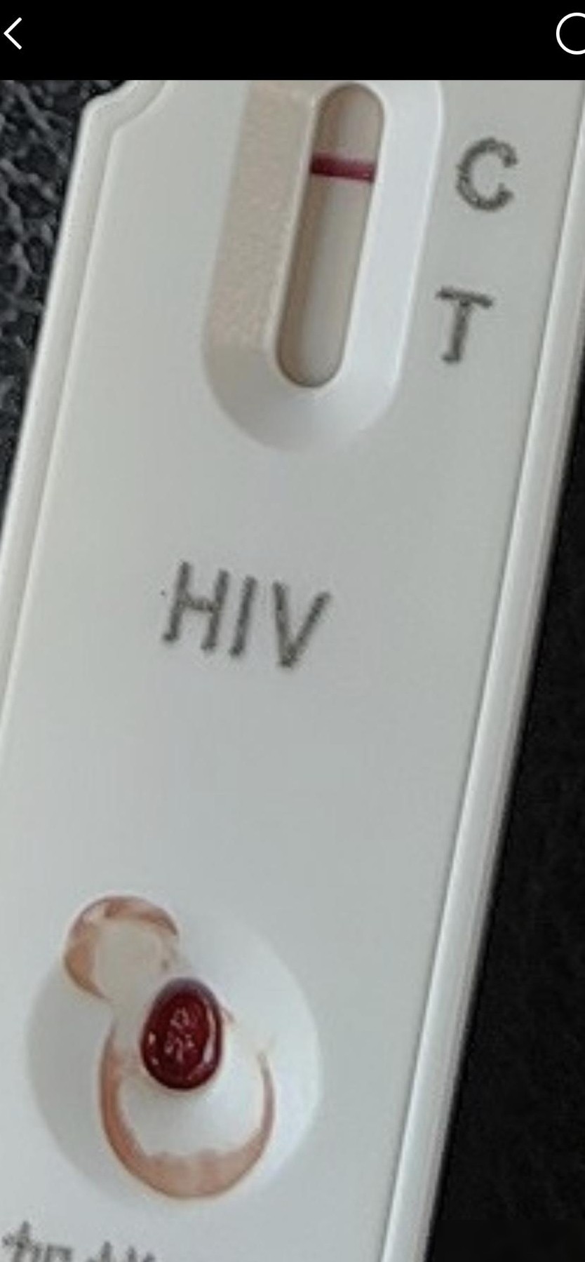 这是包埋线吗？