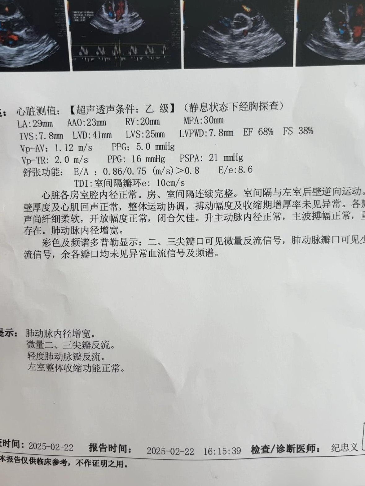 心脏不适，胸闷气短心痛