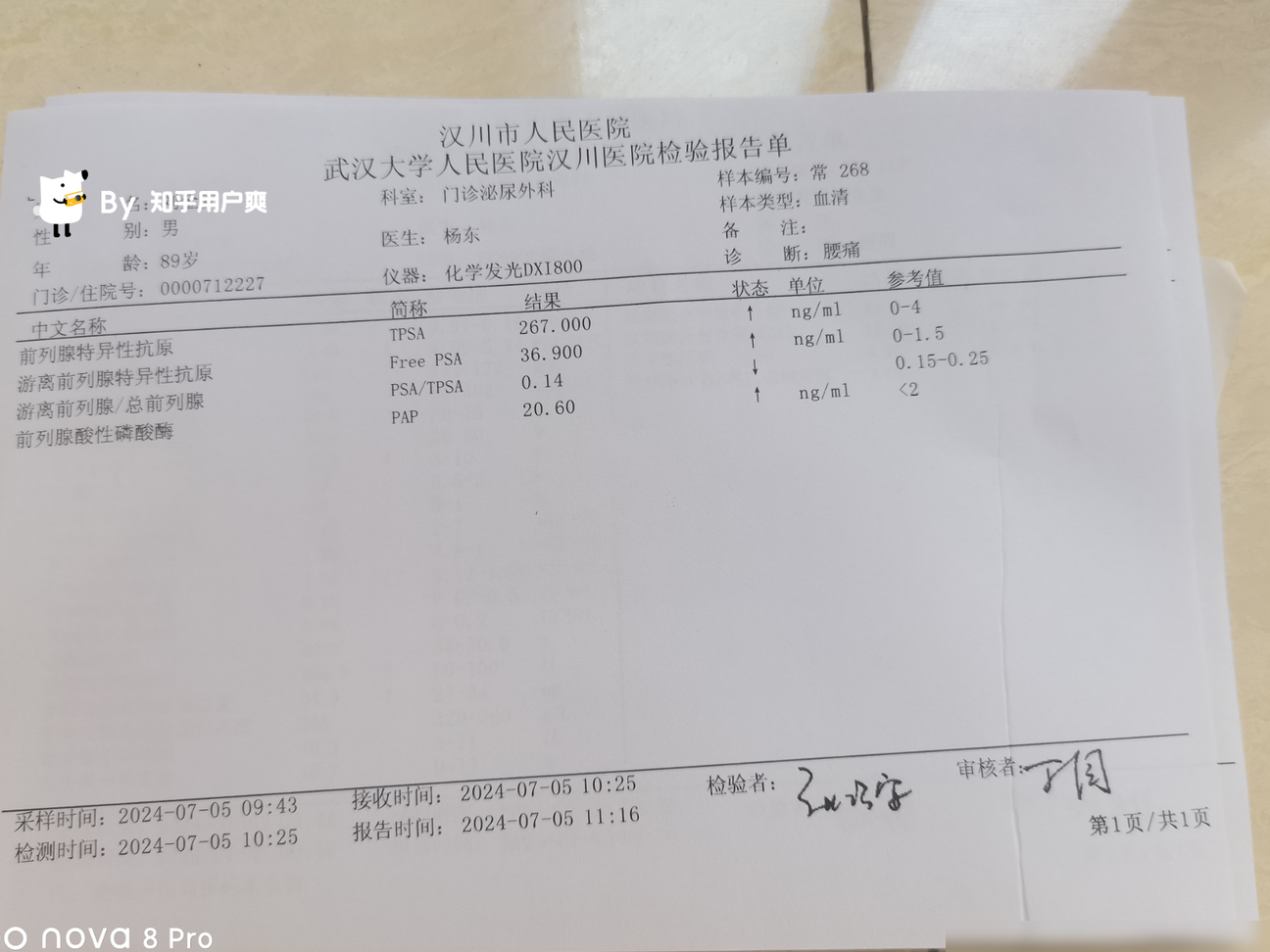TPSA 267，是前列腺癌吗？