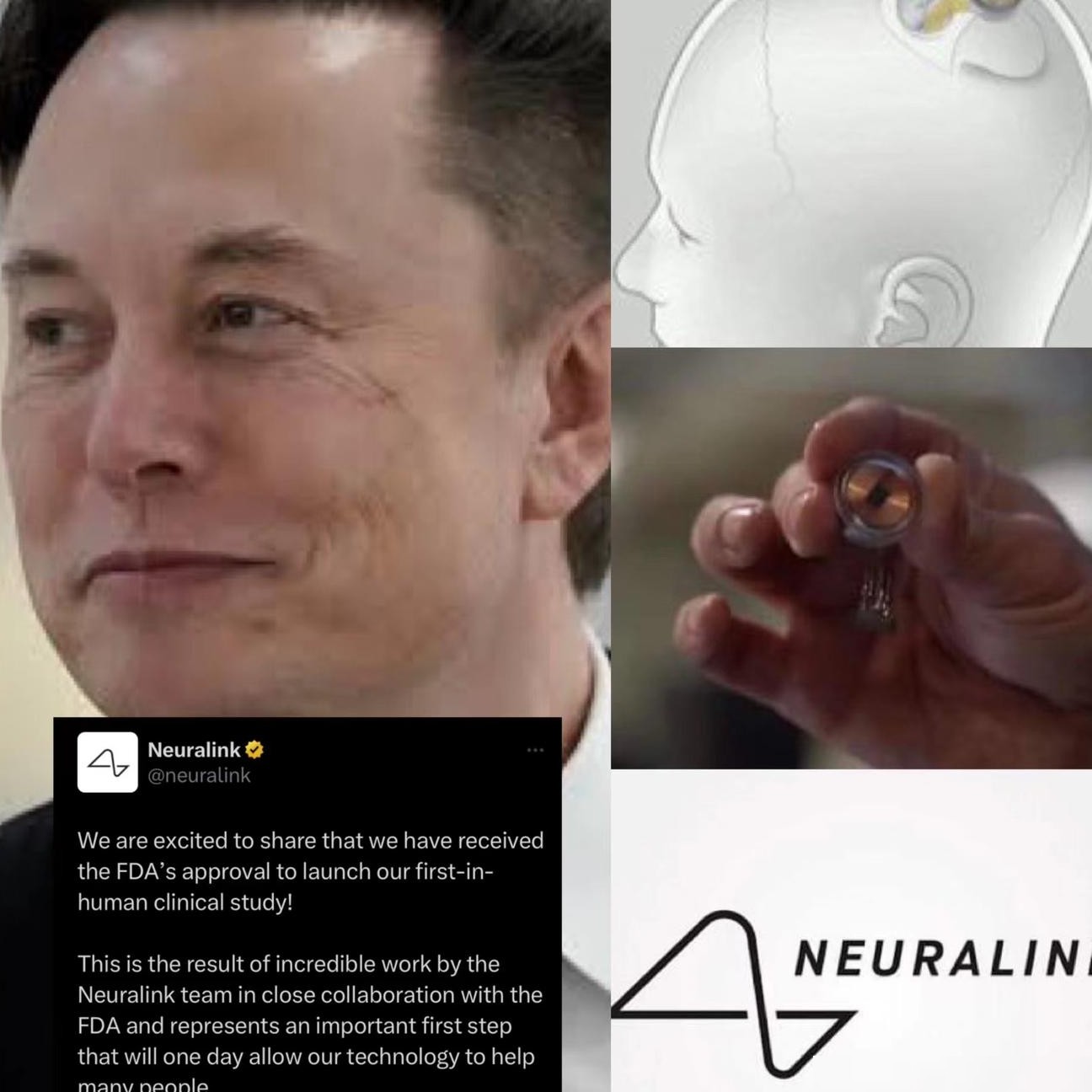 Neuralink获FDA批准首个人体试验