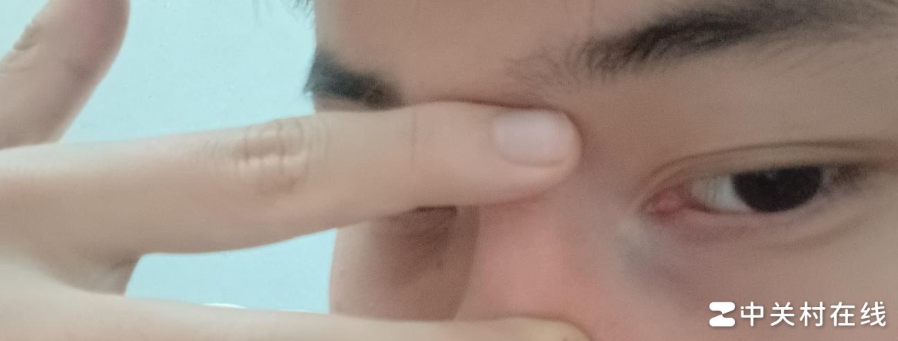 黑眼圈消除真相揭秘