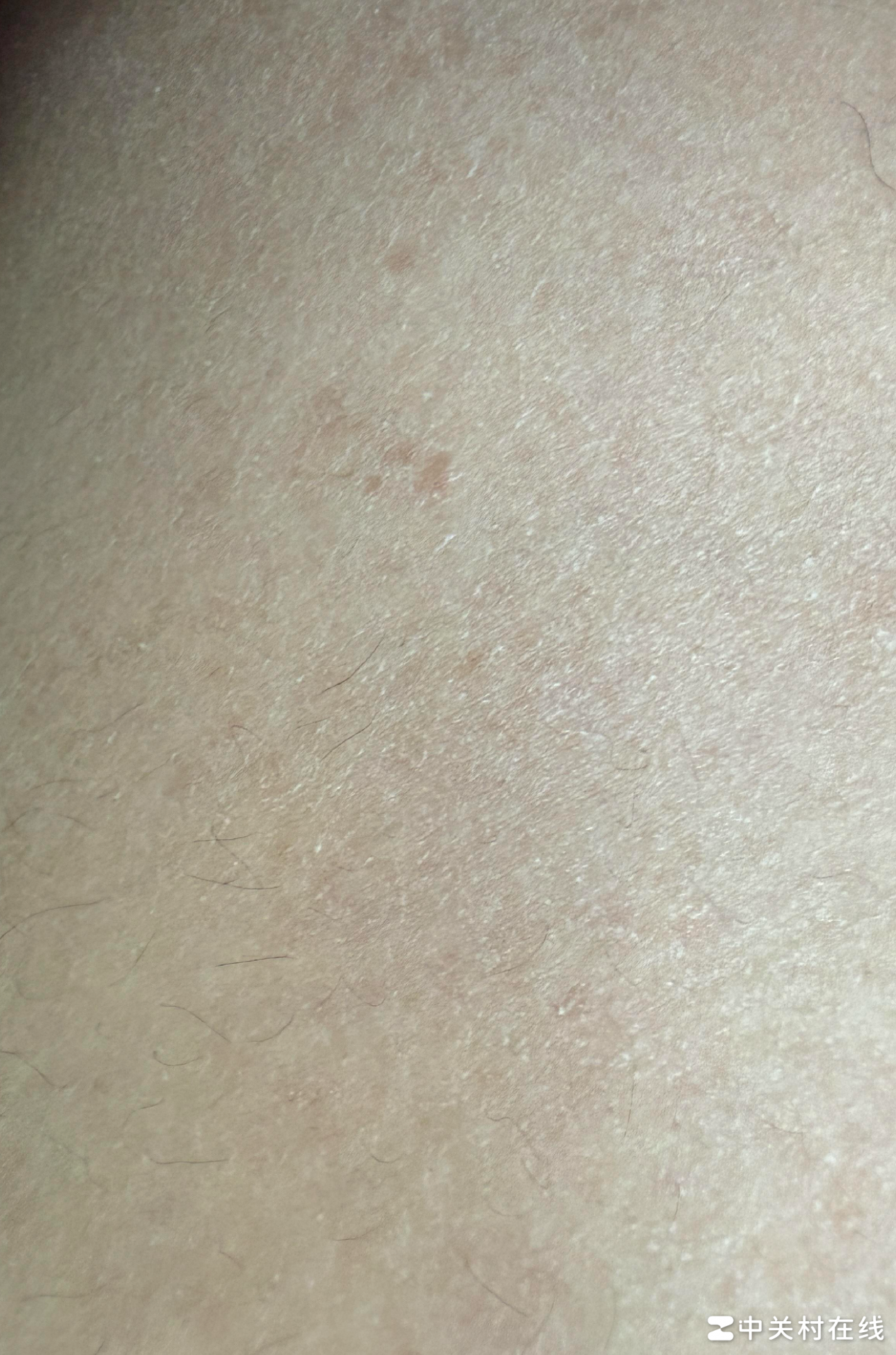 梅毒检测结果异常疑虑