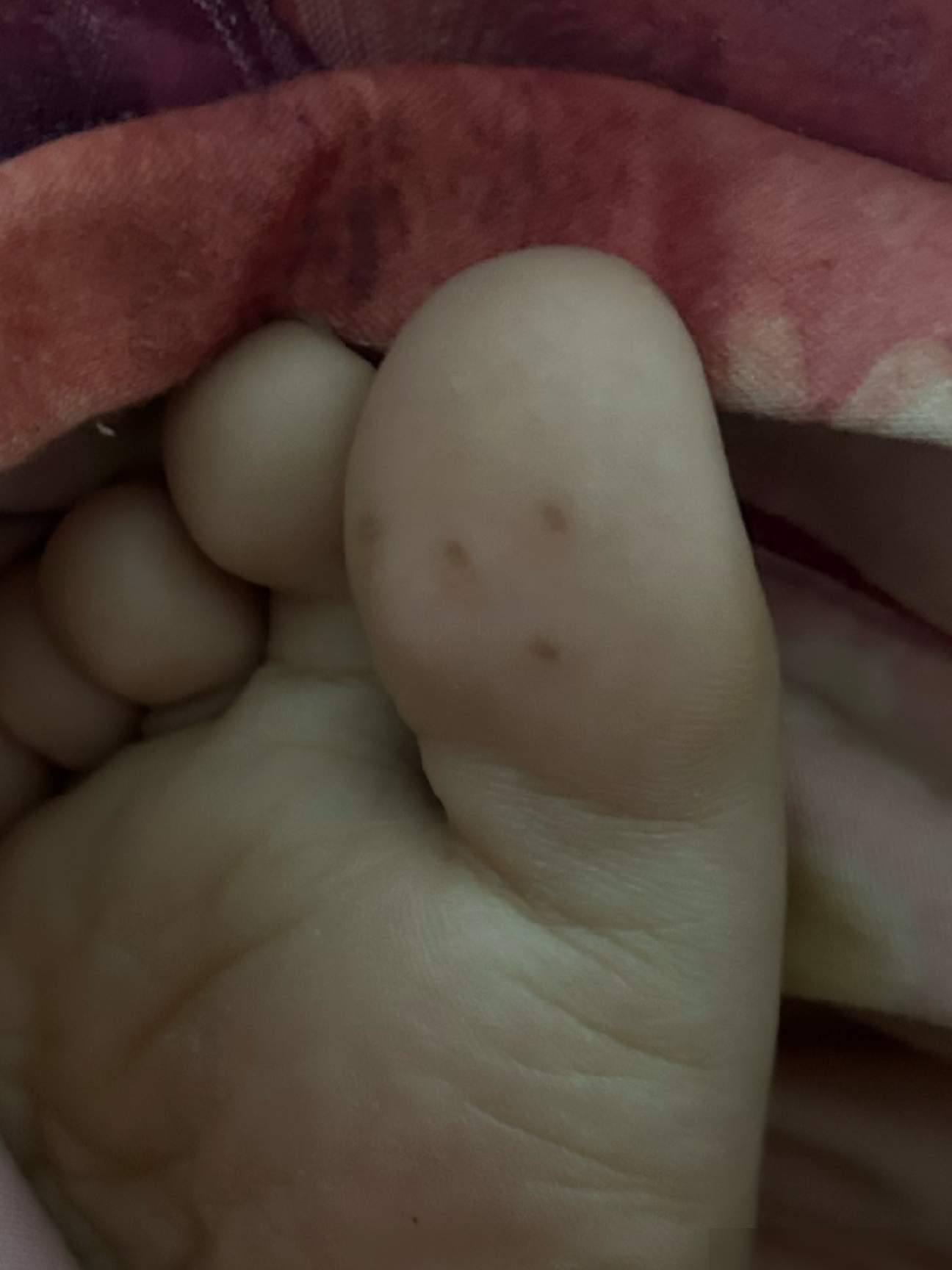 脚上长了东西是什么？