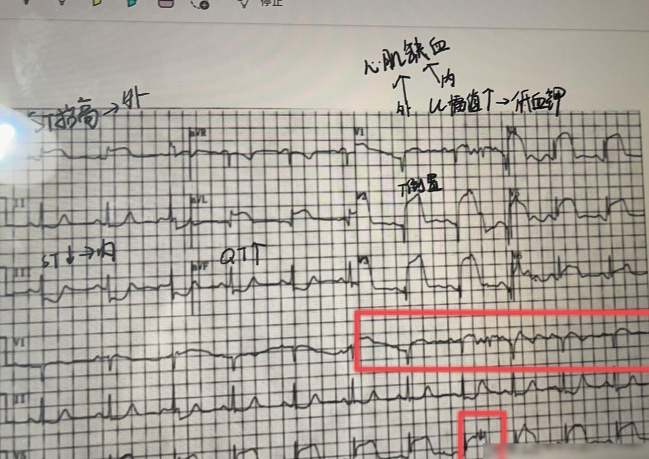 心电图诊断快速入门