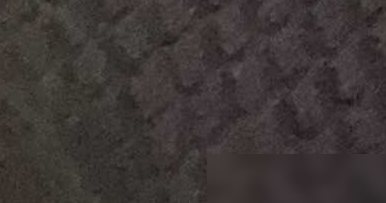 严重脸歪矫正方法