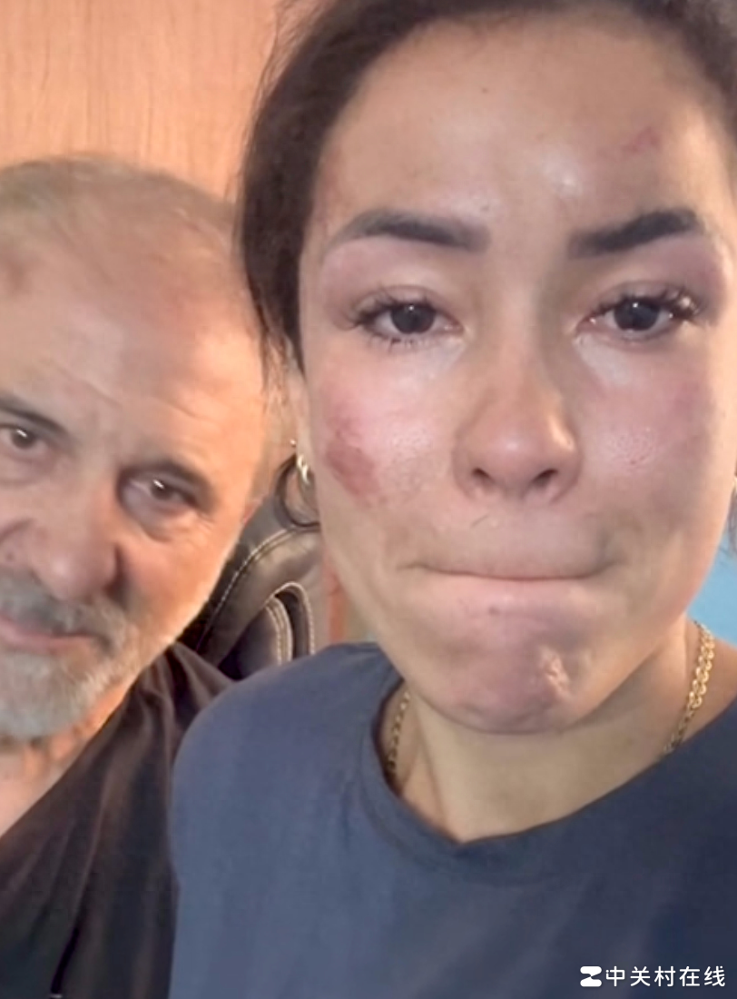 西班牙女演员印度遭袭