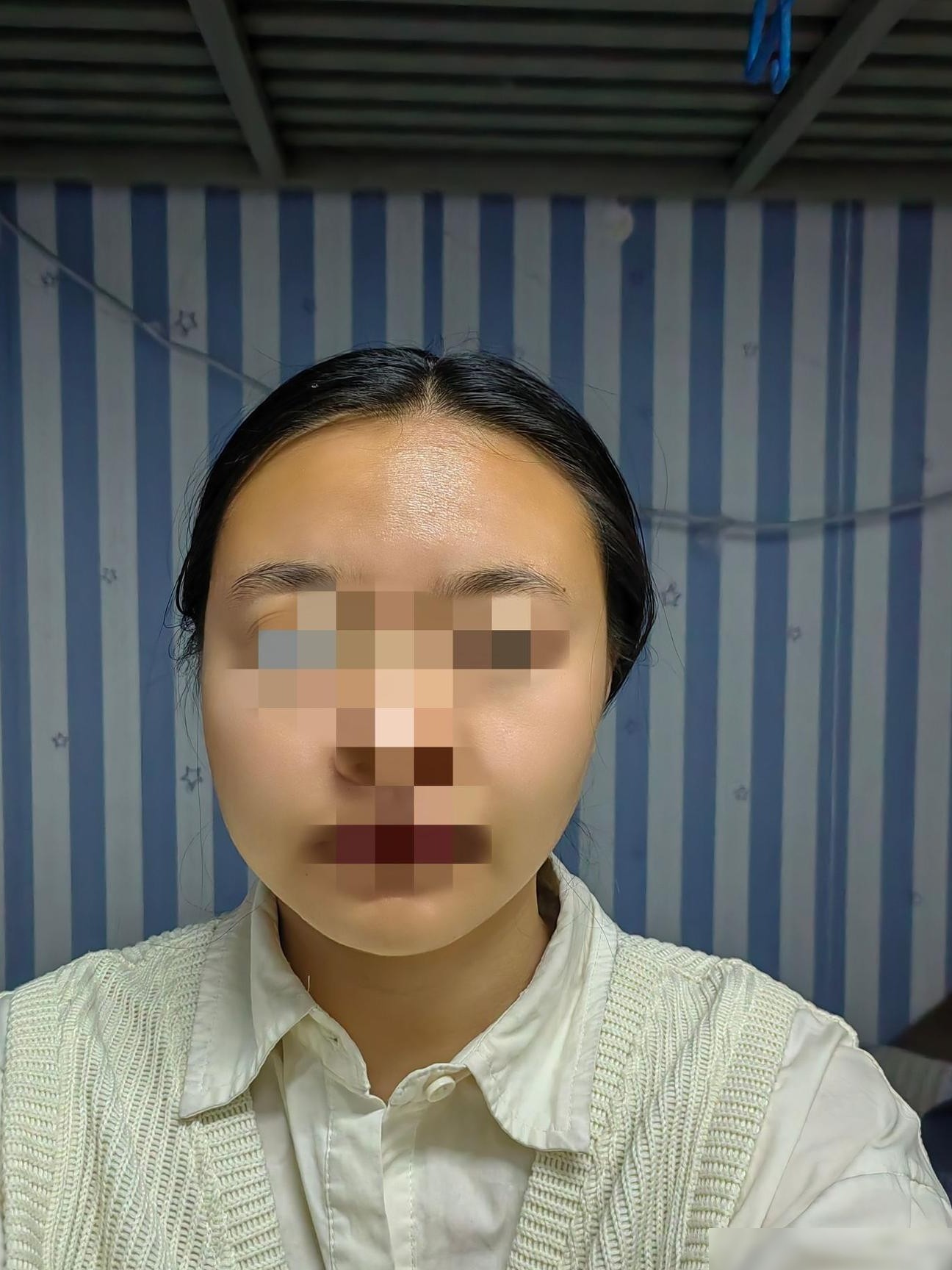 改善大小脸的实用方法