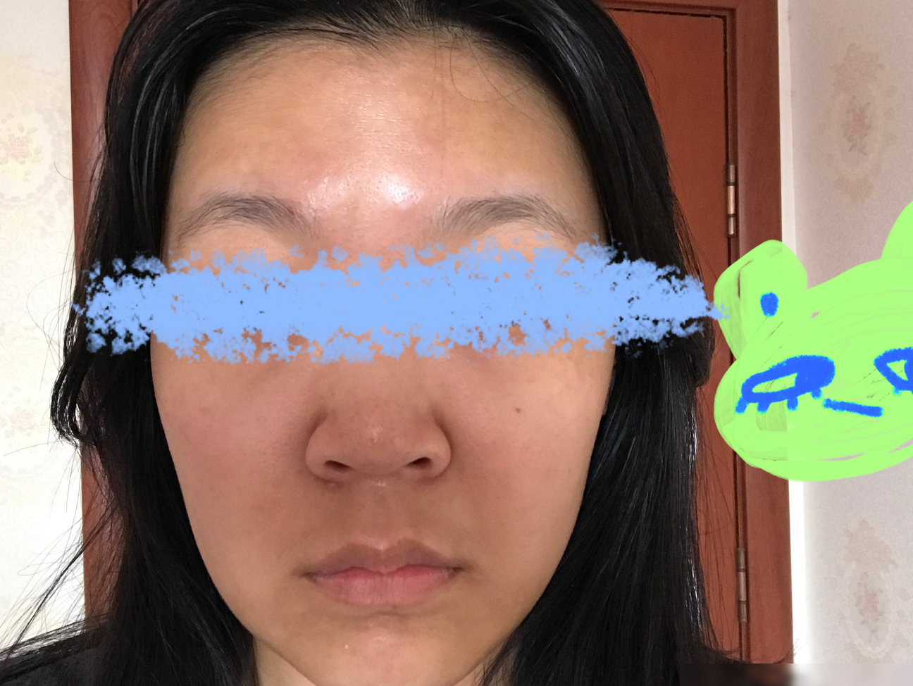 脸不对称的快速改善方法