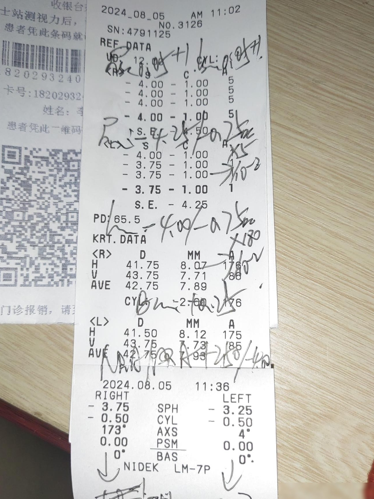 手写验光单如何配镜