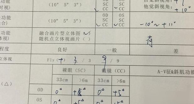 同视机斜视度报告解读