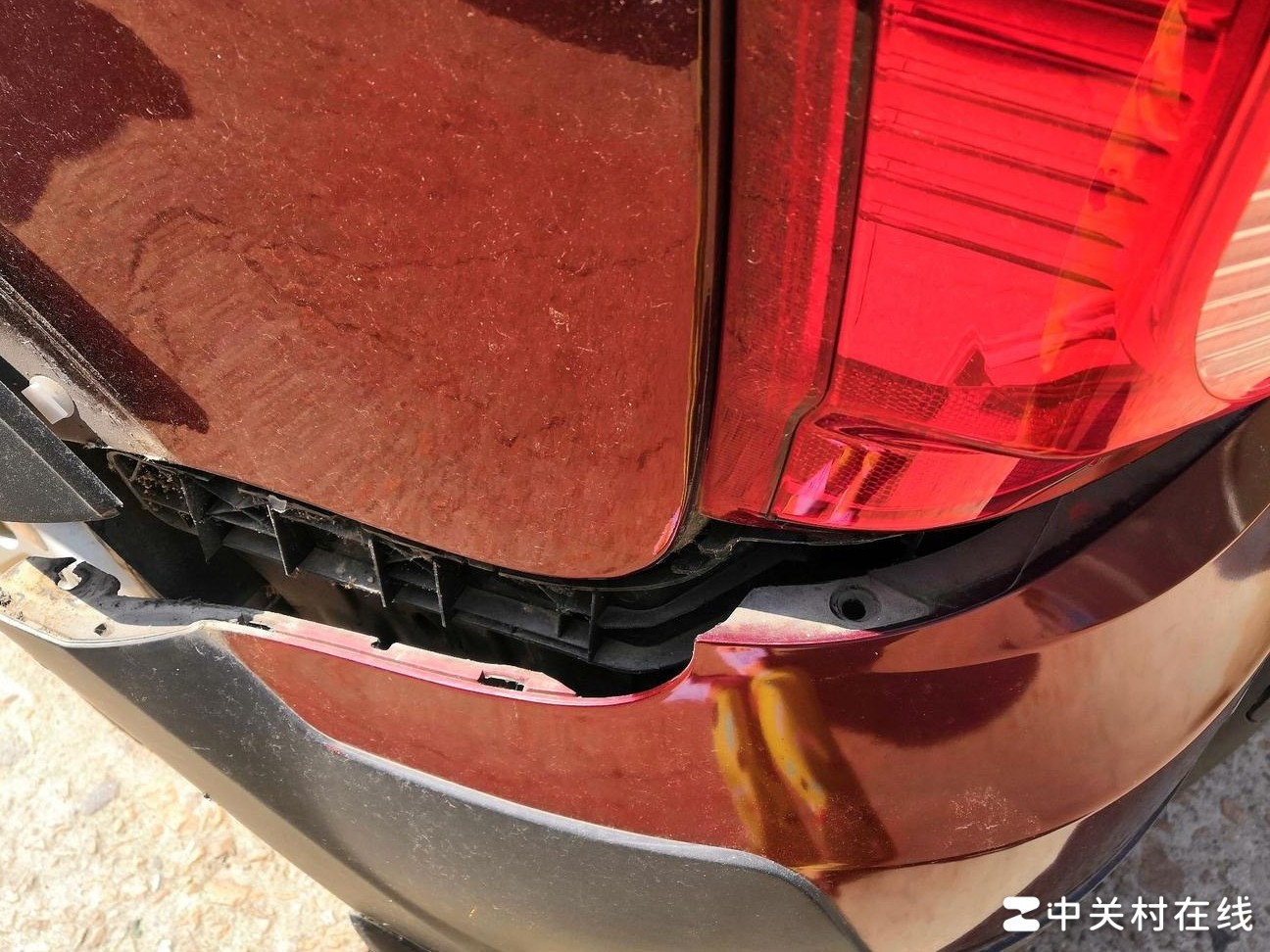 倒车撞尾，伤情评估