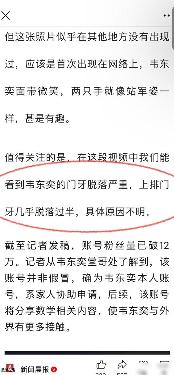 韦神门牙脱落原因及治疗