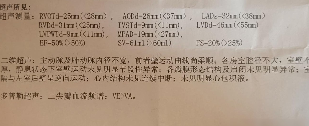 心脏EF值50%是否正常
