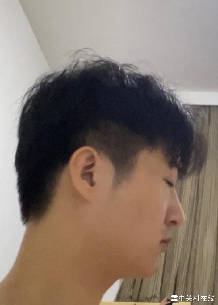 左右脸不对称原因揭秘