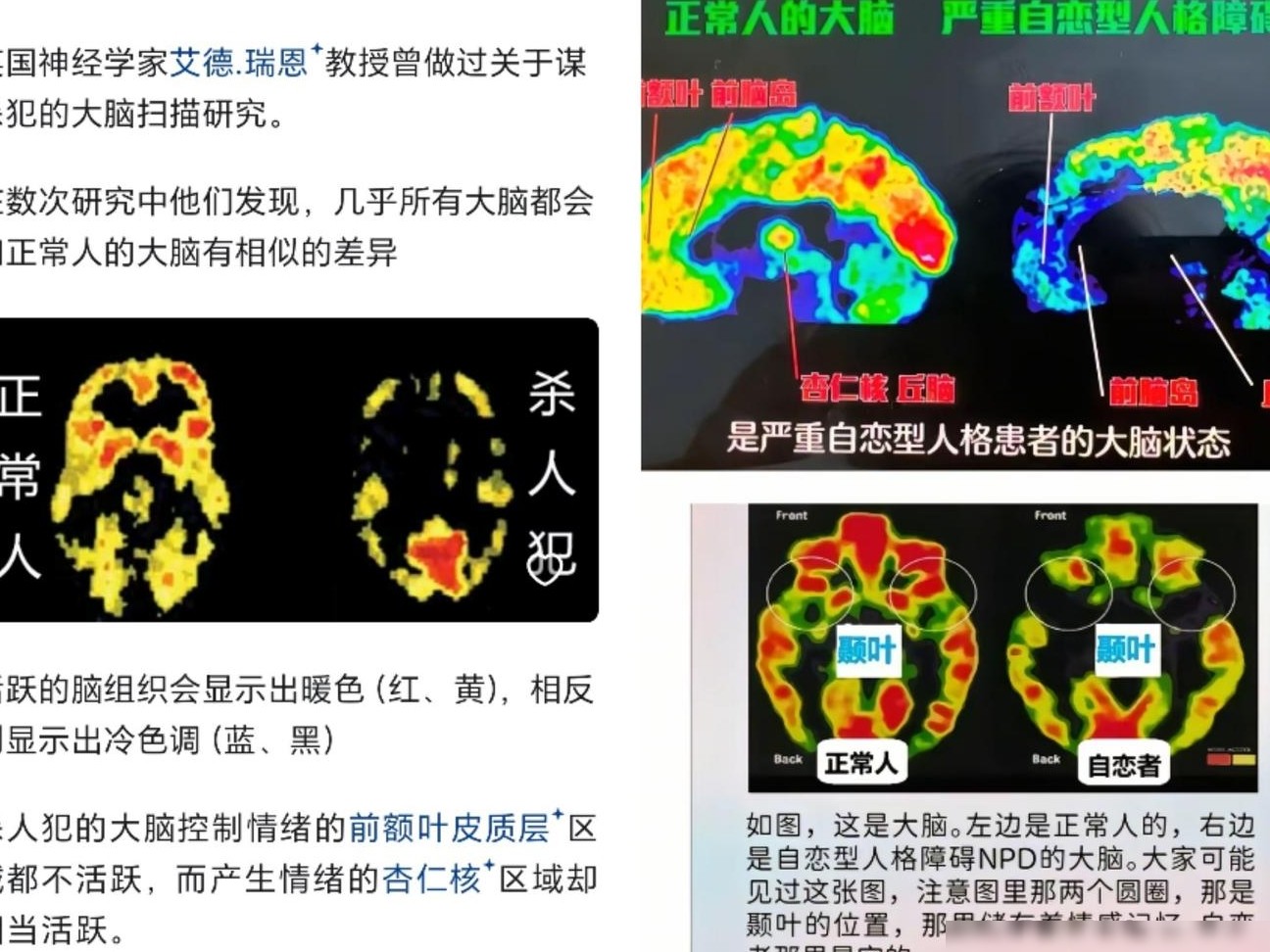 纯粹之恶的本质