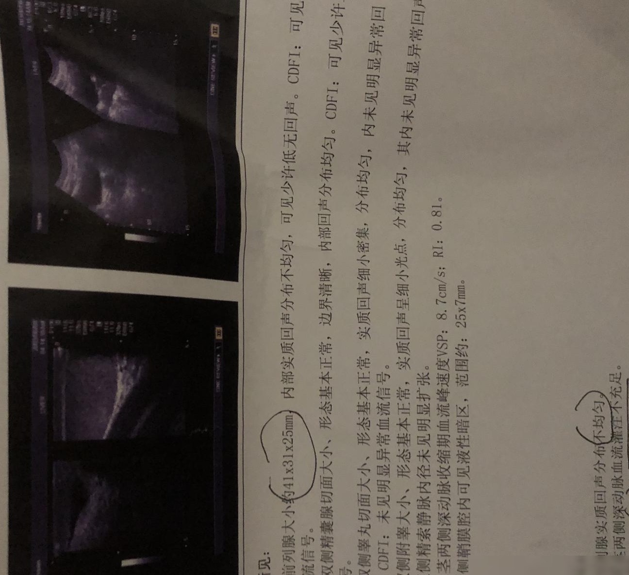 男科医院查性功能靠谱吗