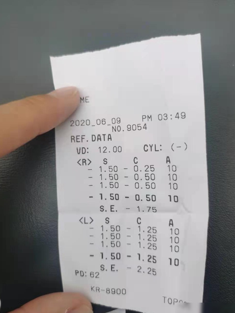 4岁宝宝未散瞳查视力