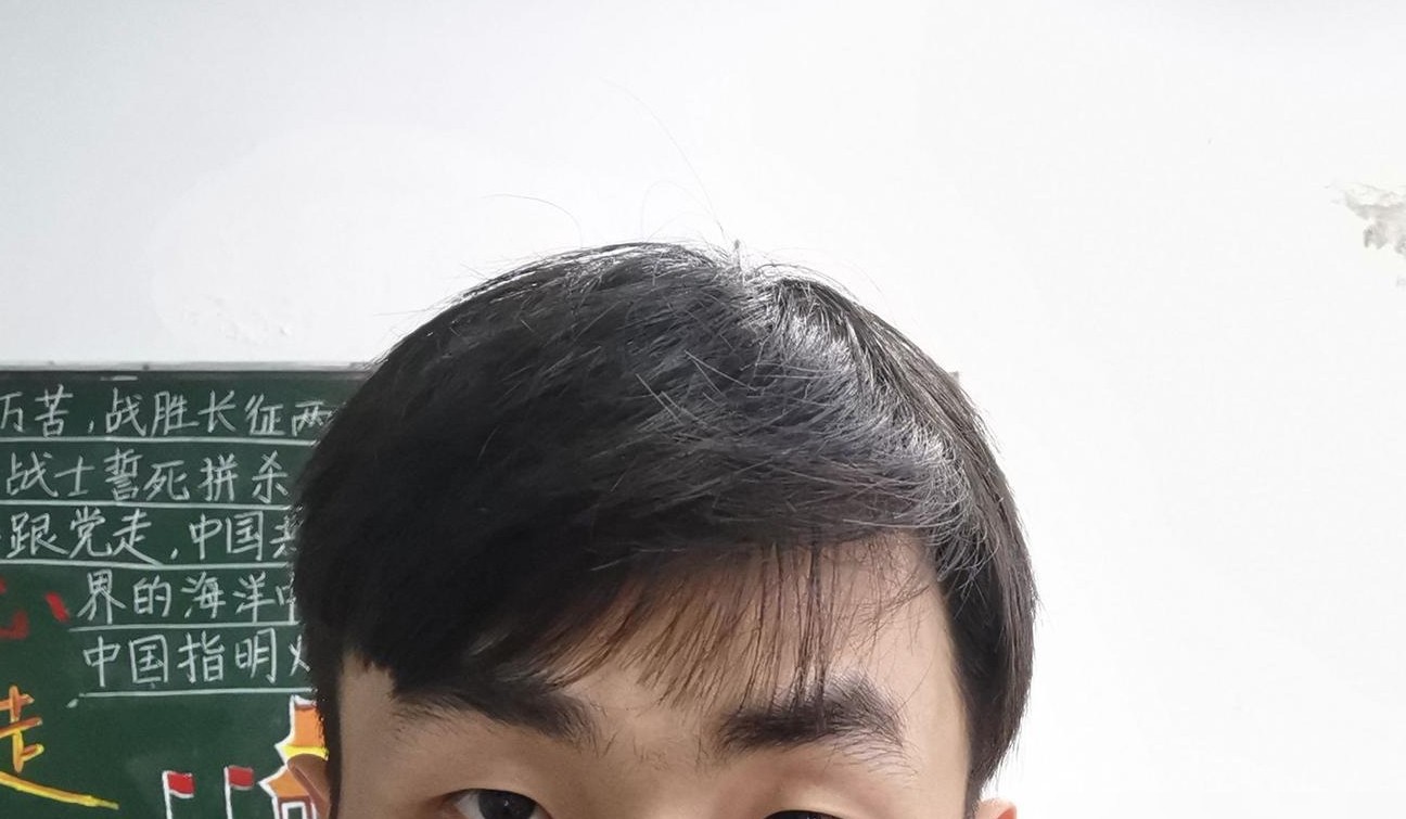 眼睛不对称怎么办？