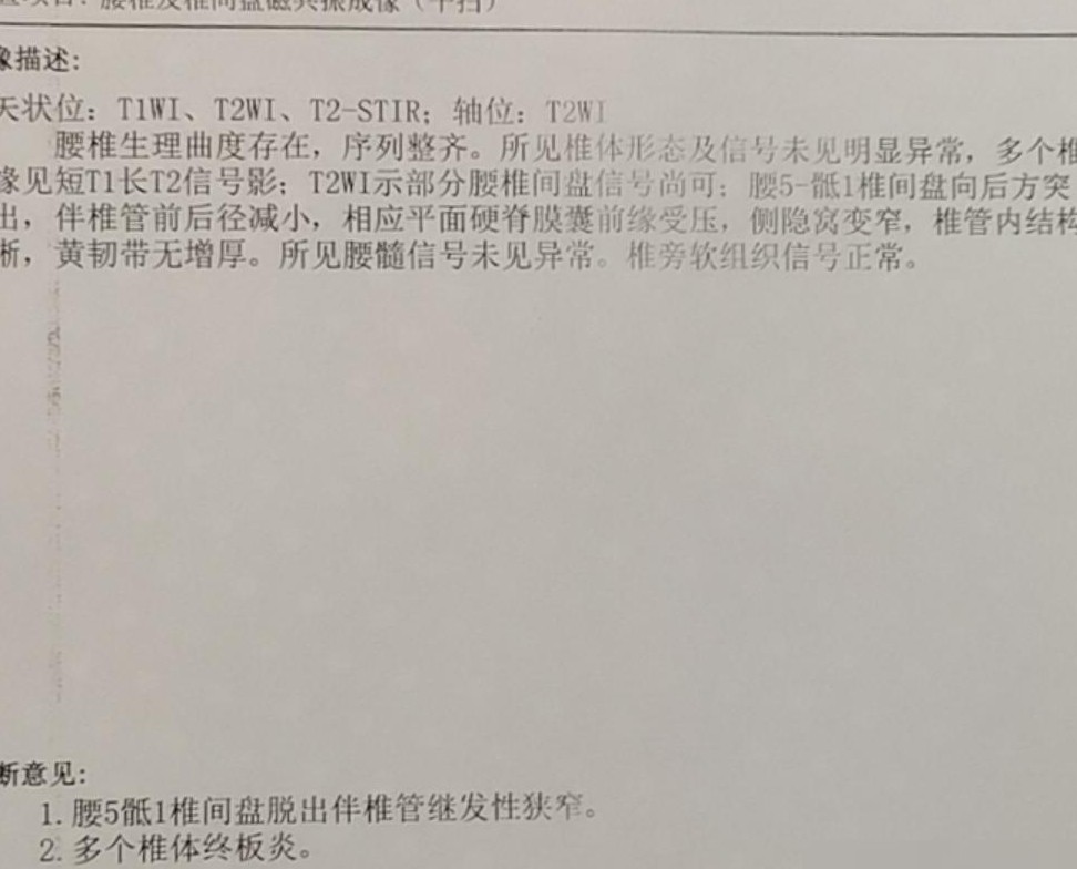 腰椎间盘突出自愈经验