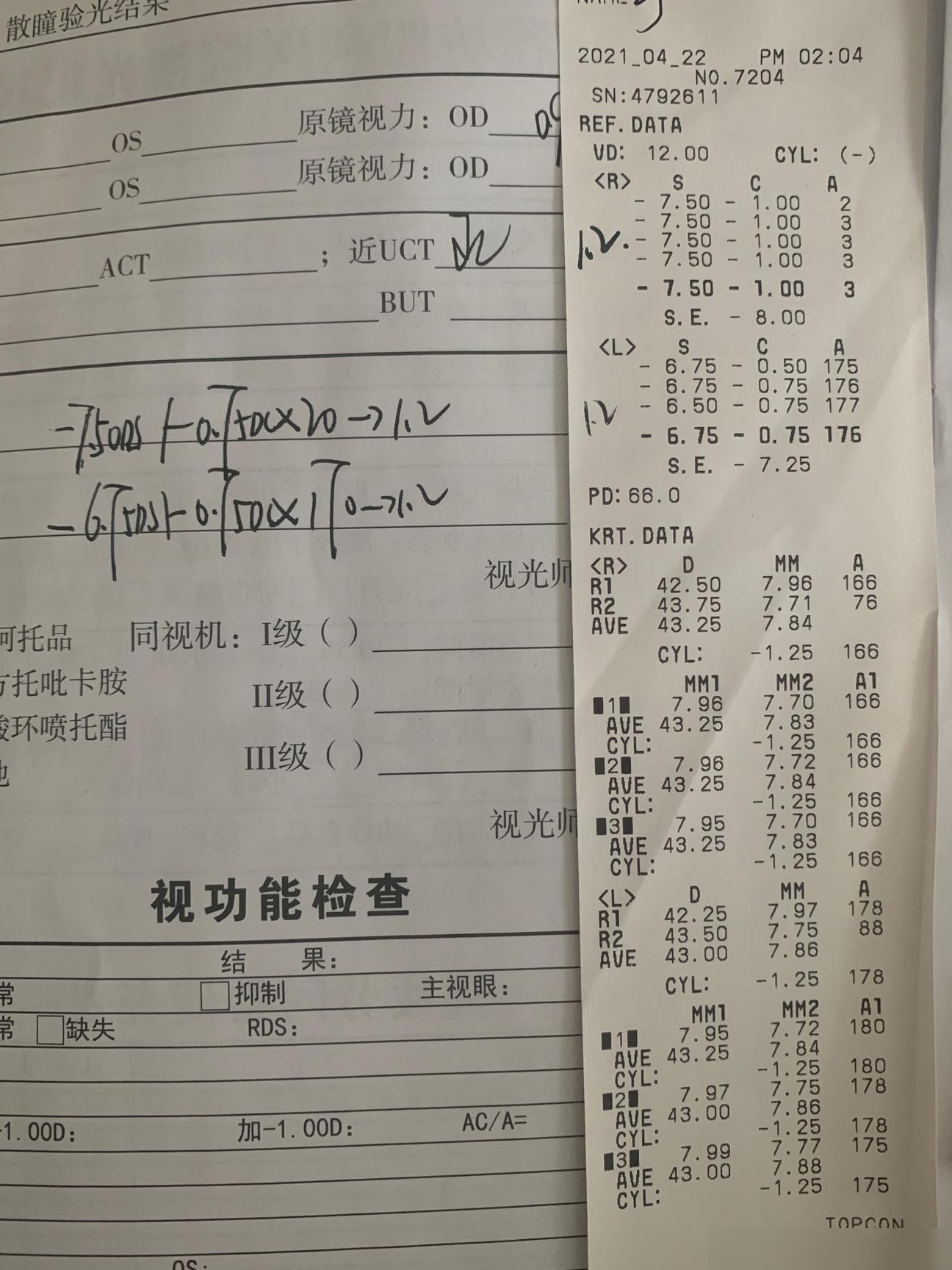 验光单中KRT.DATA含义