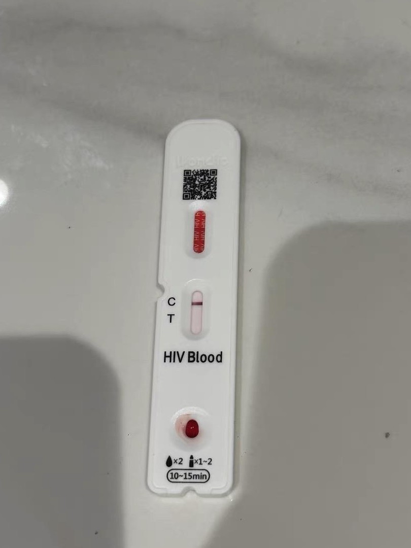 HIV试纸采血方法是否准确