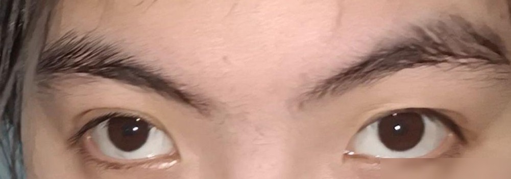 眉毛眼睛不对称怎么办