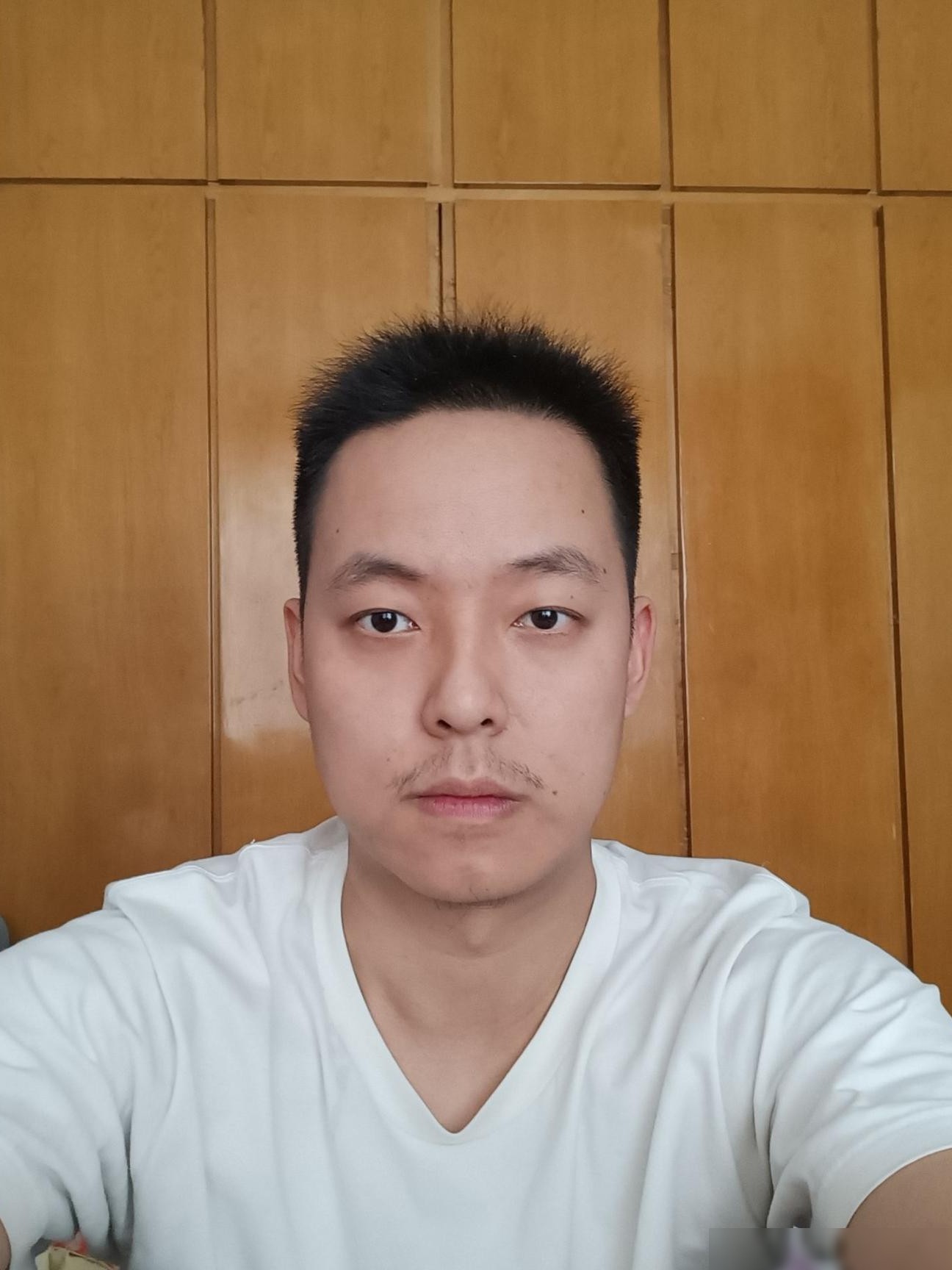 脸不对称怎么办？