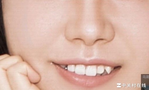 修图多次后放大现绿杠