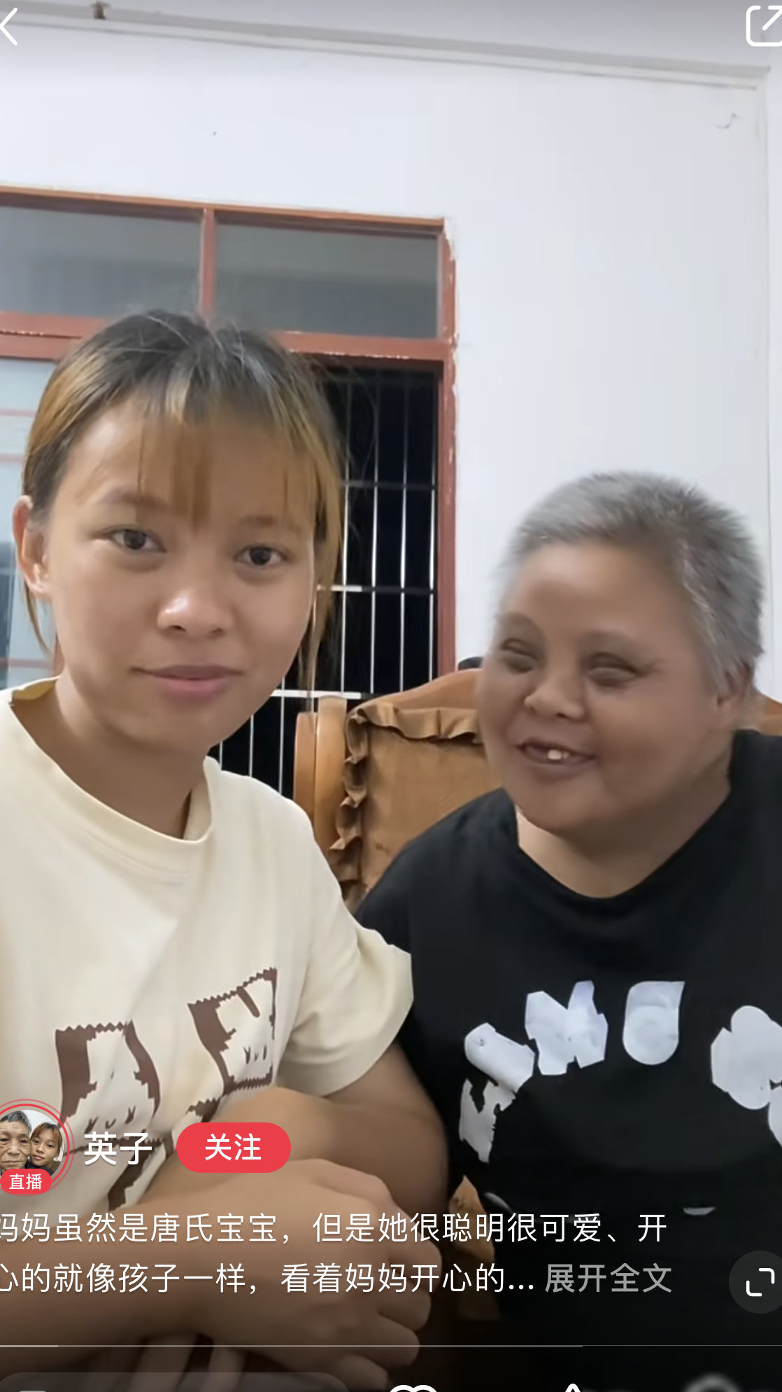 唐氏患者生育能力揭秘
