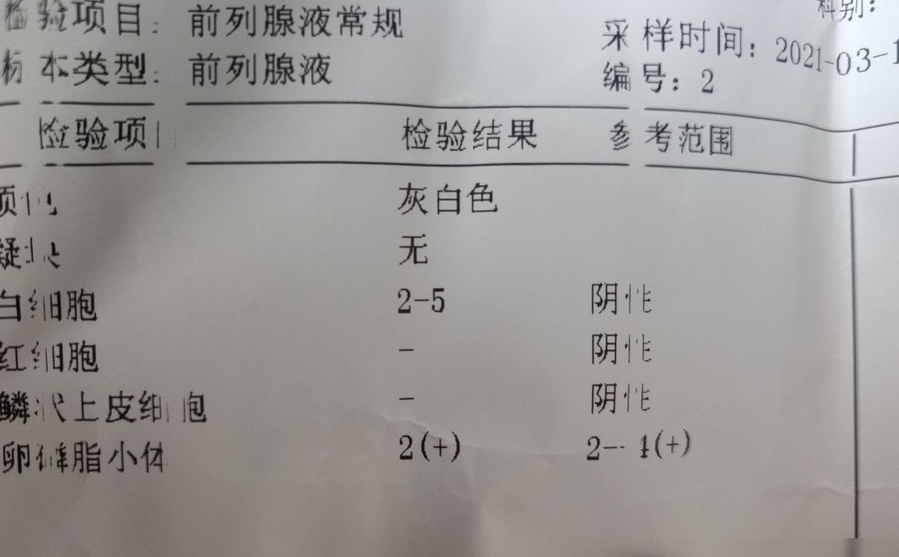 前列腺液检查详解