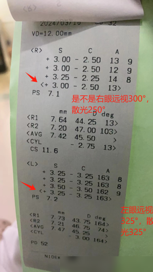 视力检测图怎么看？