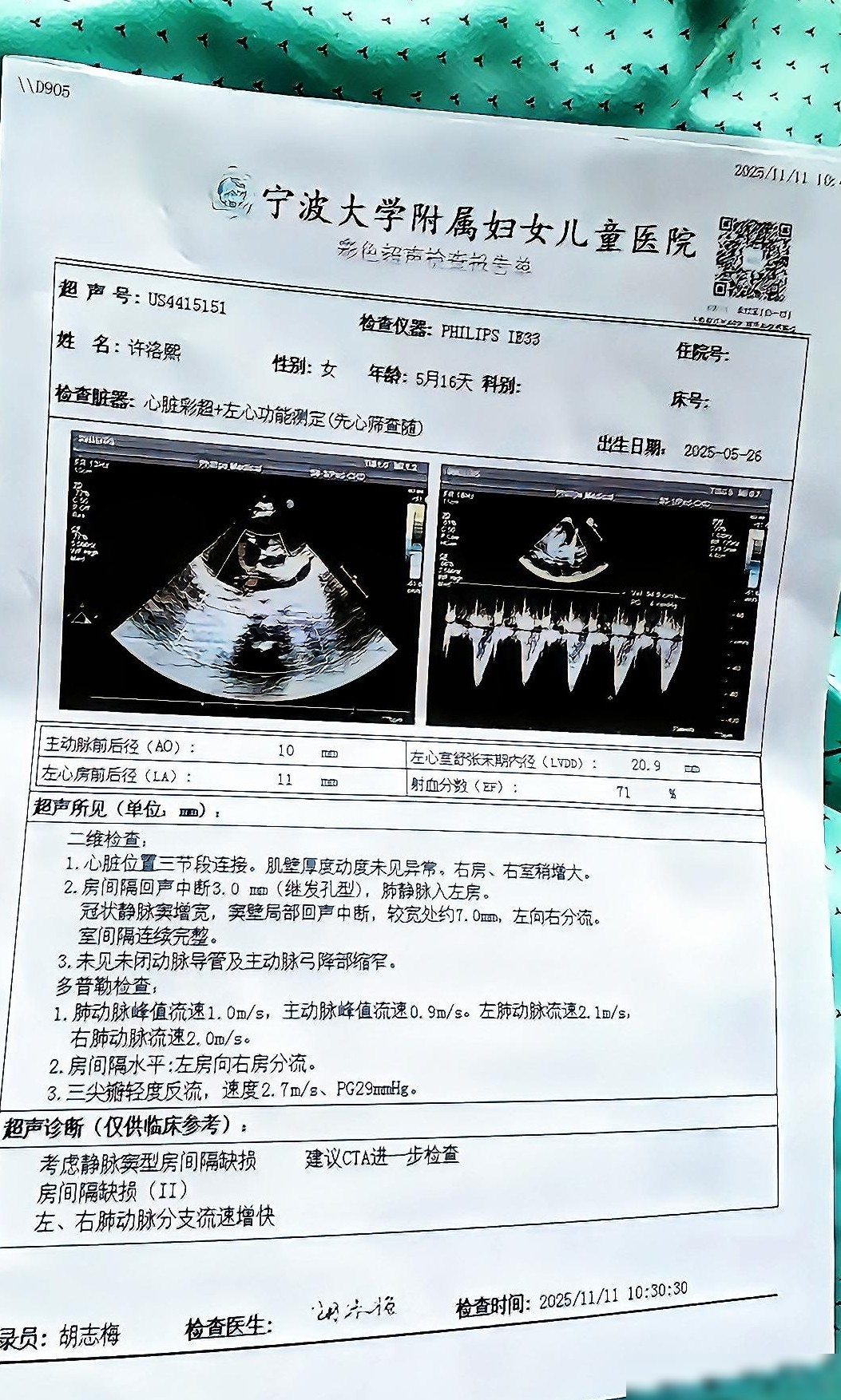 许洛熙继发性孔测量误差之谜