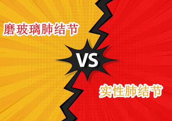 磨玻璃结节更需警惕