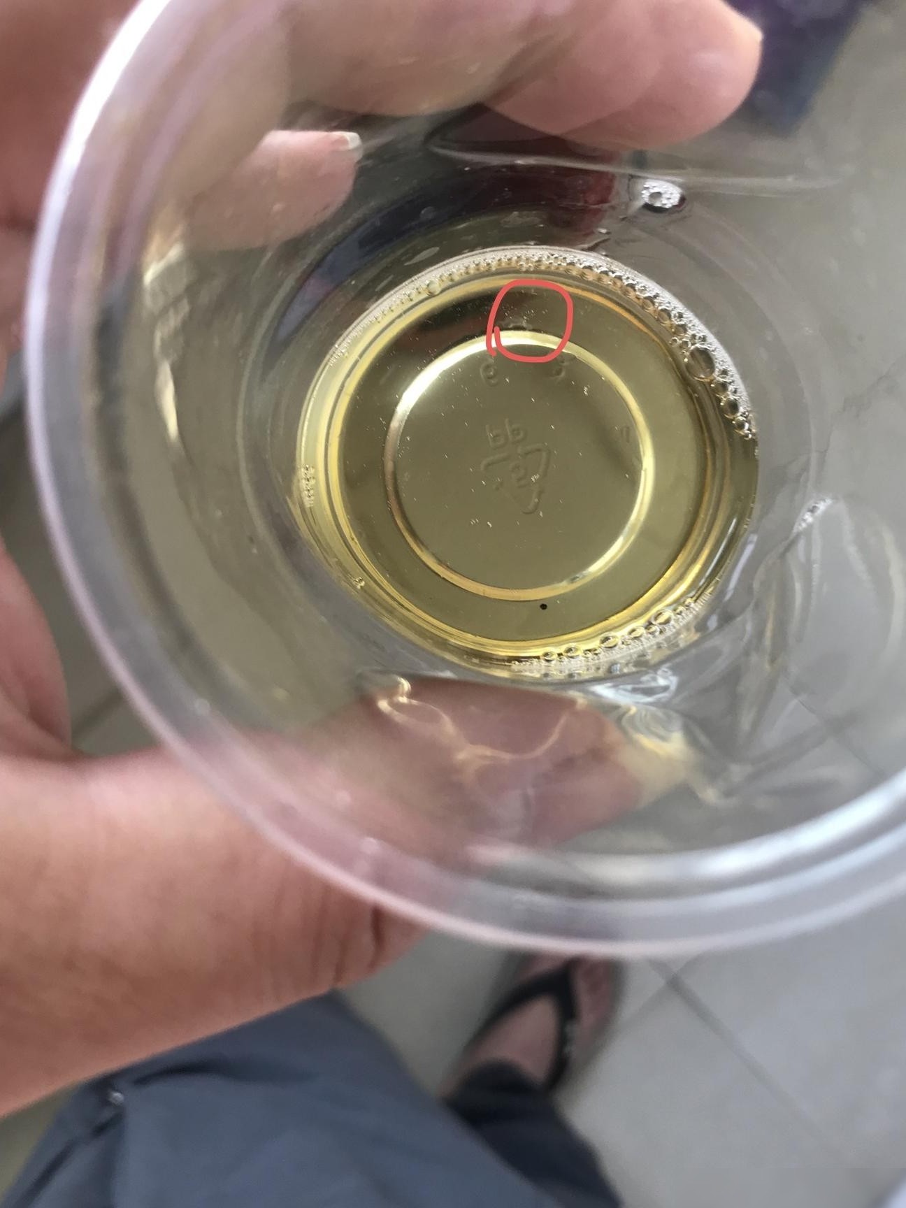 慢性前列腺炎能治愈吗？