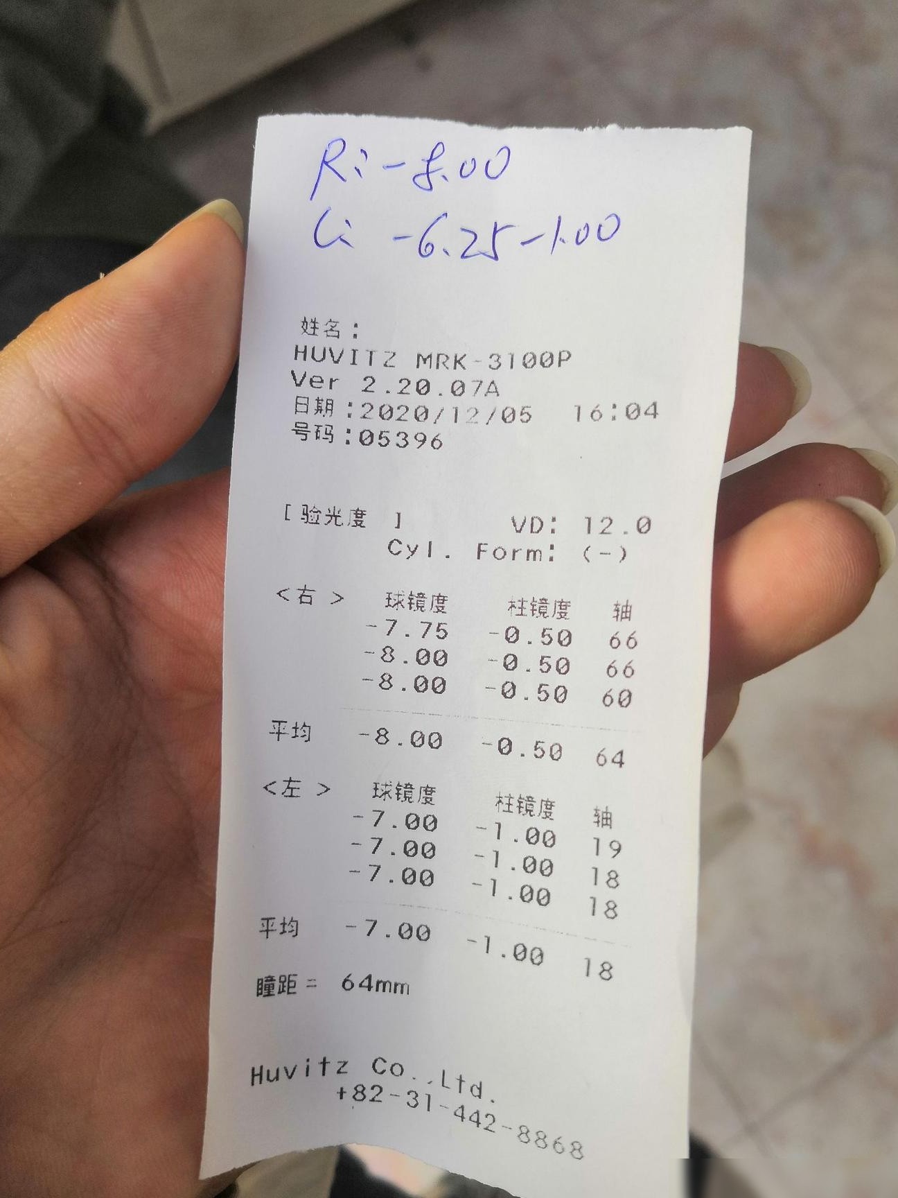 验光单上如何看基弧