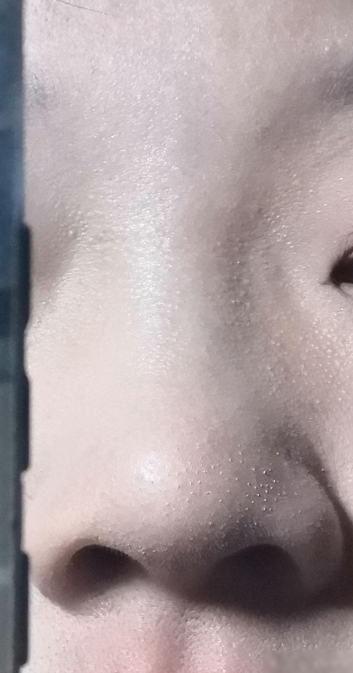 化完妆后脸上的小白点是白头吗