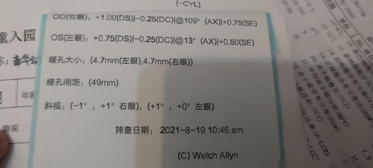 2岁宝宝视力数据怎么看