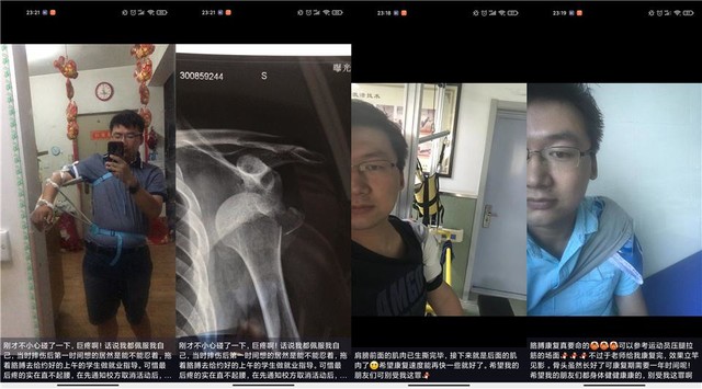 看颜值喜欢上的筋膜枪,我是否交了智商税?野小兽筋膜枪使用有感
