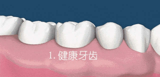 智能洁齿不伤牙——扉乐FiliX声波电动牙刷评测