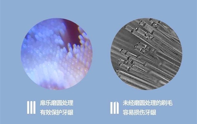 智能洁齿不伤牙——扉乐FiliX声波电动牙刷评测