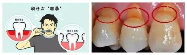 智能洁齿不伤牙——扉乐FiliX声波电动牙刷评测