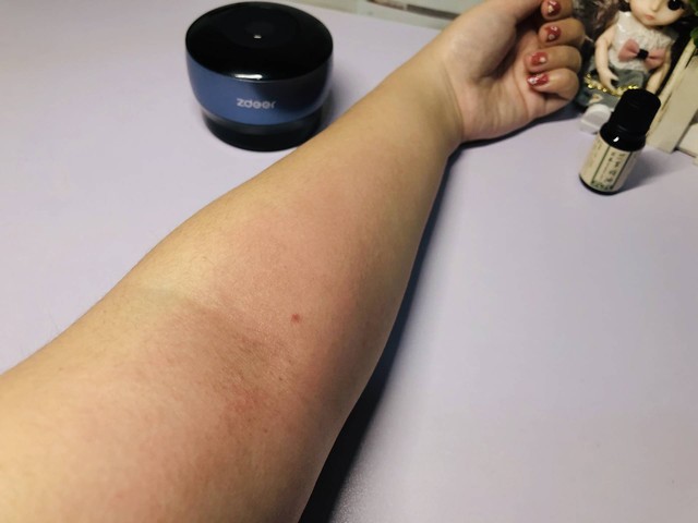 有了左点智能走罐按摩器,足不出户就可以实现美容院级出痧效果
